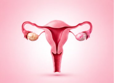 Gynecology